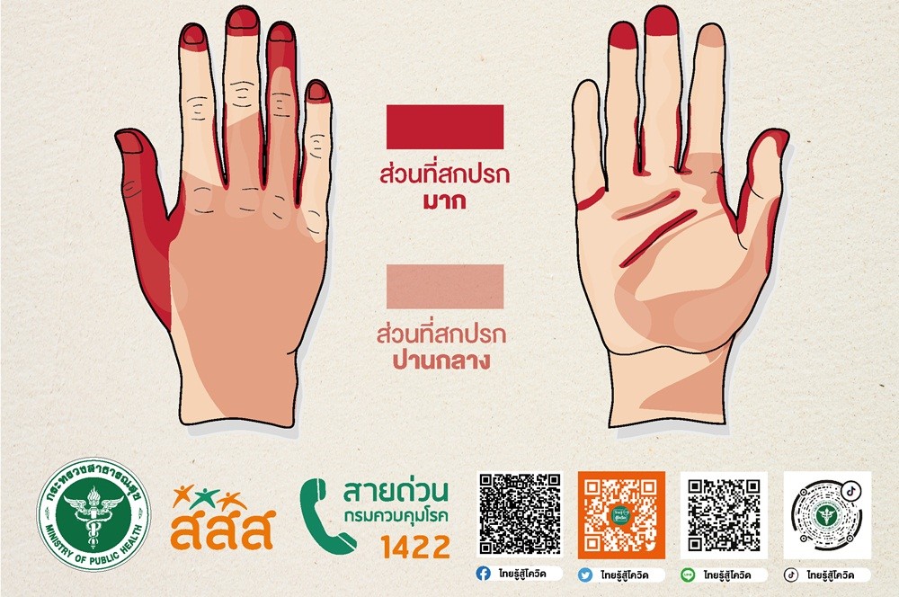 ส่วนไหนของมือที่สกปรกมาก thai-herbs.thdata.co | ส่วนไหนของมือที่สกปรกมาก สรรพคุณ สมุนไพร ไทย 